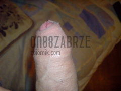 on88zabrze