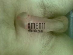 xmen11