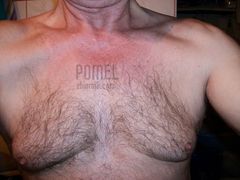pomel