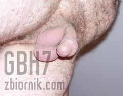 GBH7