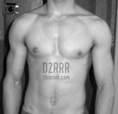 d2rrr
