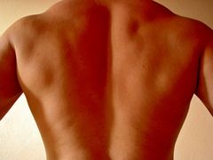 blazing