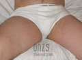 onzs