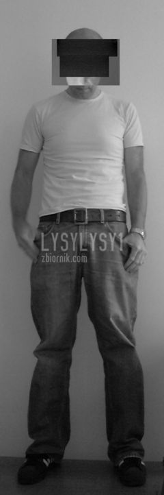 lysylysy1