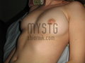 mystg