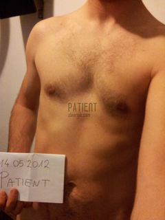 Patient