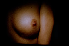 pola_992