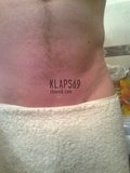 klaps69