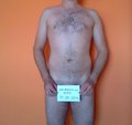 hpx