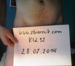 Klol92