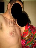 paralodz321