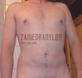 zaniedbanylbn