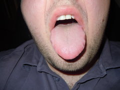 panczorax