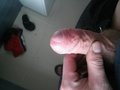 chudy535