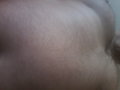 blumer