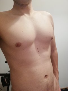 BratBasi2