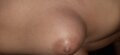 orevtonixot