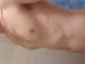 Remco