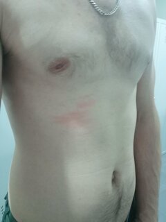 Nudesy_anonim