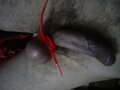 Skinyman15