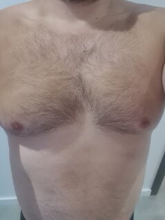 NAPALONY__1987