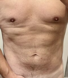 Erozeus1978