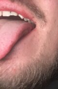 Lopezek12