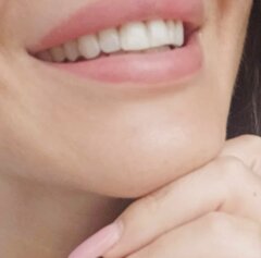 Lara_Kiss