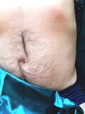 Opozytor