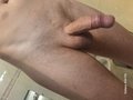 Prostypenis