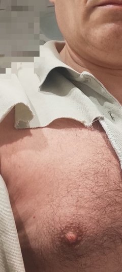 Labia