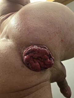 Magic_Holes