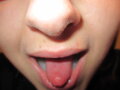 Steo_