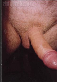 #06