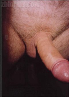 #12