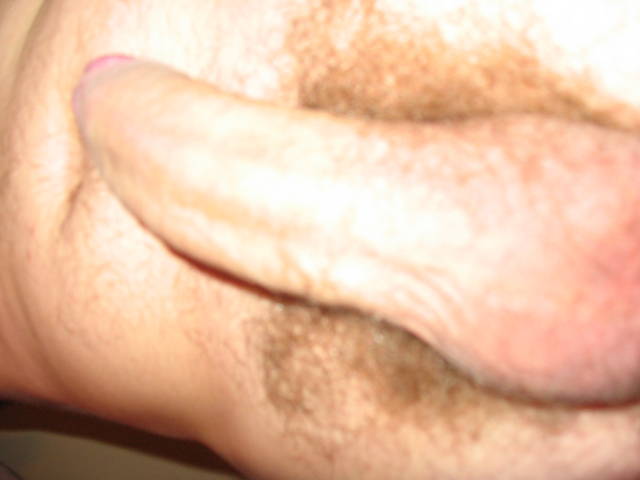 RAF10