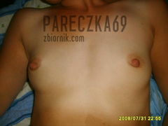 plaska zonka