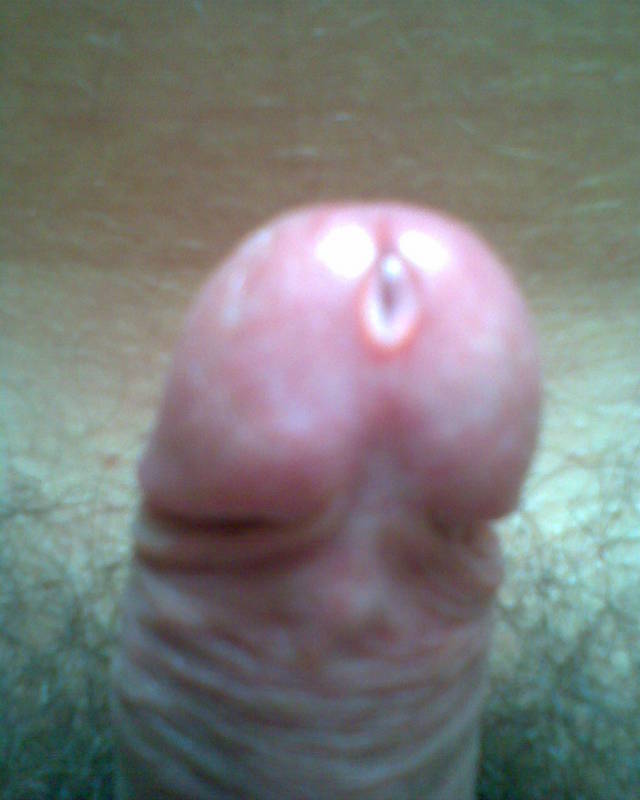 taadeo
