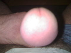 Lepek ;-)