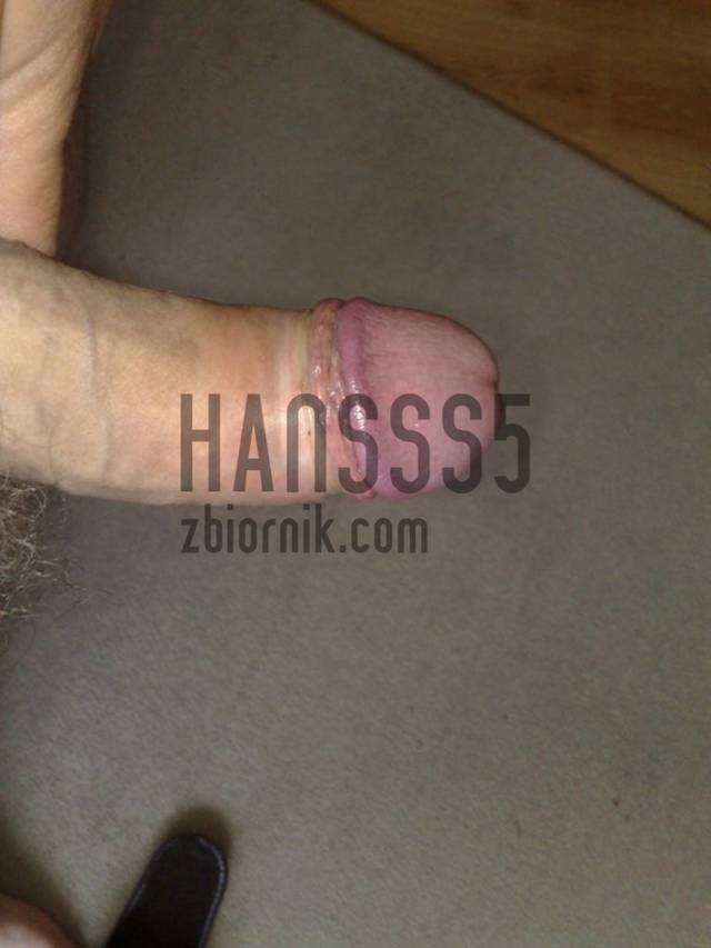 hansss5