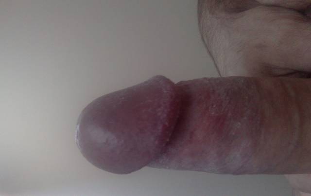 xxlla