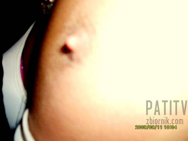 patitv
