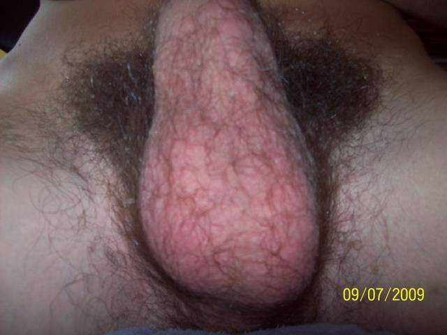 bii