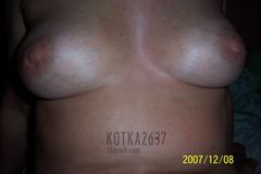 KOCICA