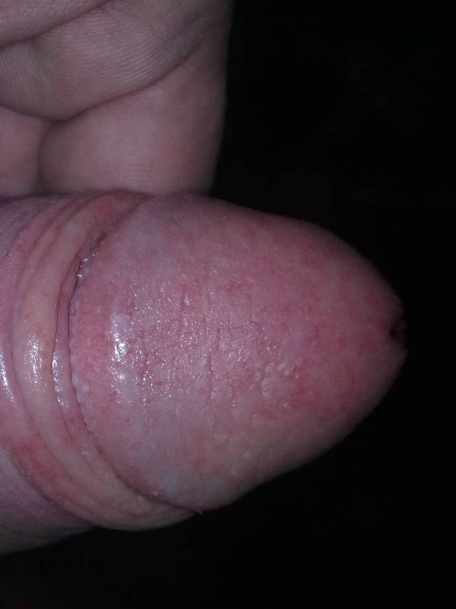 tomek132