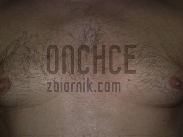 klatka.jpg - ONchce