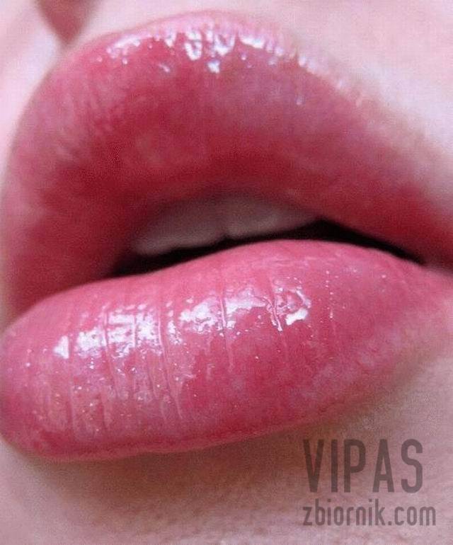 VIPas