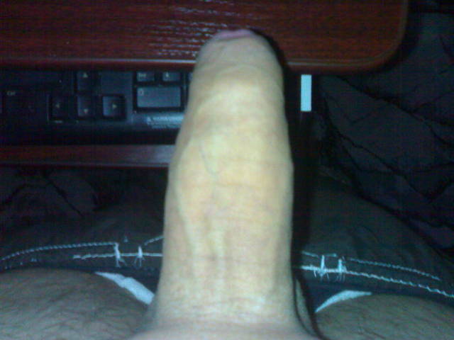191020093388.jpg - spermikon
