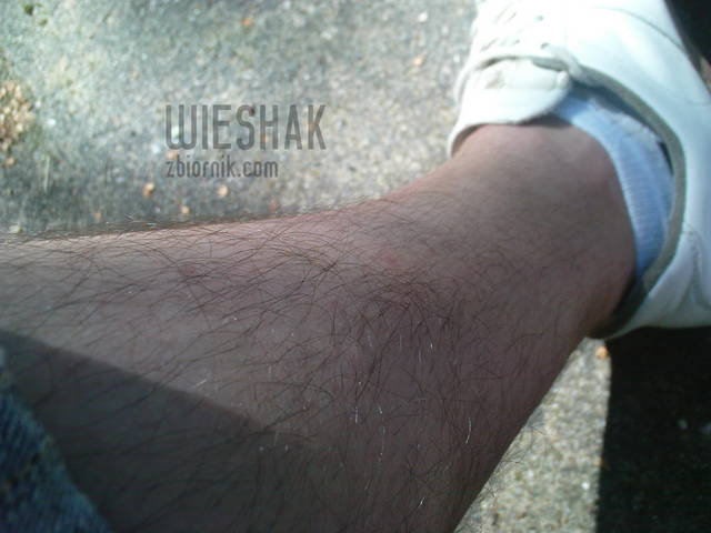 noga - wieshak