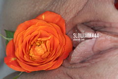 różyczka